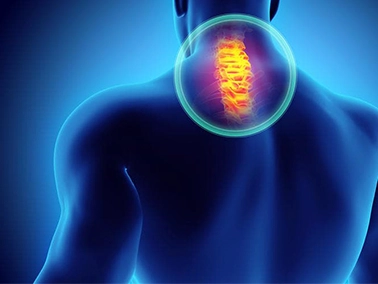 Cervical