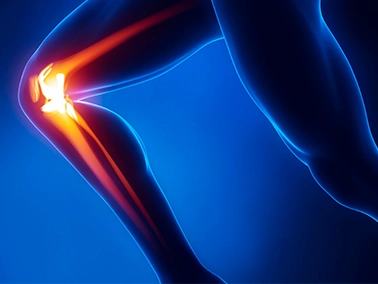 Rodilla